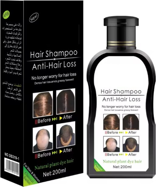 Aichun Beauty Anti Hair Loss Shampoo-200ml